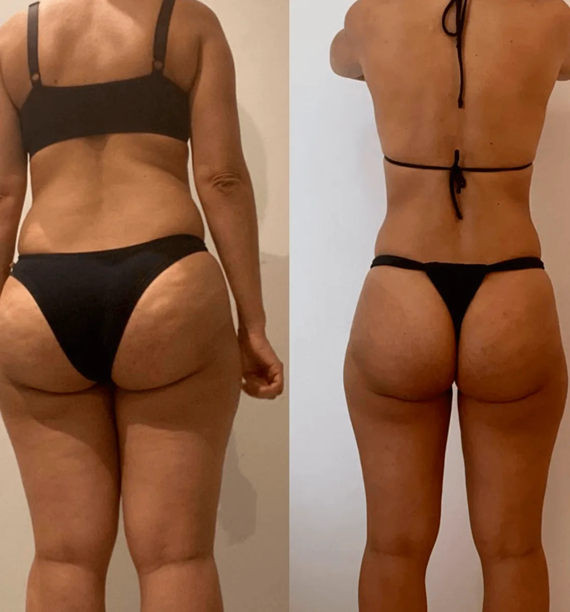 Evolução física de aluna, antes e depois